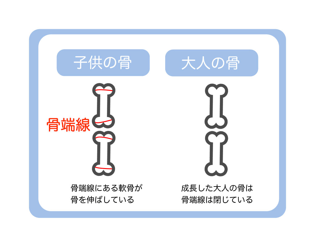 骨単線の図